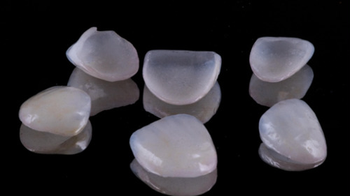 Six translucent porcelain dental veneers displayed on a black reflective surface