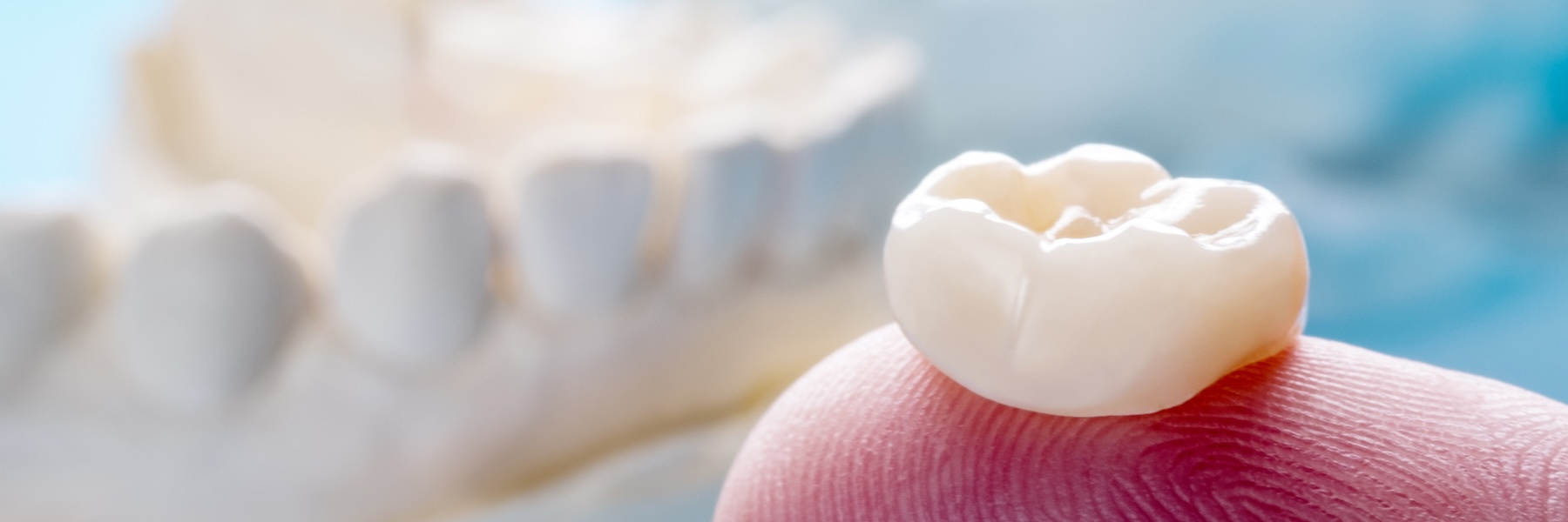 CEREC® Same-Day Crowns | Dentist