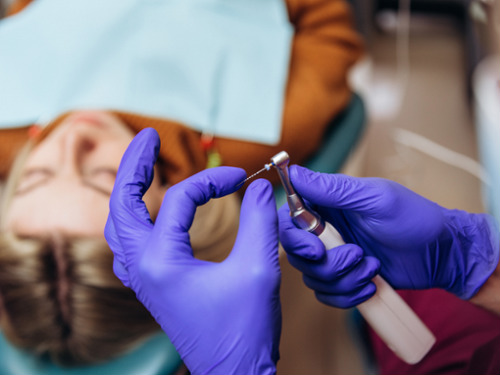 Rotary Endodontics